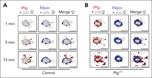 Plasminogen rapidly localizes to fibrin ring during hemostatic plug formation. Mice were injected with anti–fibrin-AF488 antibody, anti–GPIX-AF568 antibody, and AF647-conjugated, catalytically inactive rPlg. (A-B) Representative images (intravascular view) for fibrin (blue), platelets (gray), and rPlg (red) staining at the indicated time points after laser injury in control (A) or Plg−/− mice (B). Scale bar indicates 50 μm.