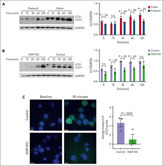 XIAP-deficient cells exhibit defective autophagic flux upon serum starvation. Immunoblots and densitometry of LC3 protein from (A) PBMC of proband and his healthy father and (B) control and XIAP-KO THP-1 cells after starvation for the indicated time. GAPDH loading control was used for normalization of LC3-II. (C) Representative immunofluorescence images showing LC3 staining in control and XIAP-KO THP-1 cells at baseline and after 30 minutes of starvation and quantification of average increase in number of LC3 puncta upon starvation. Scale bars represent a distance of 10 μm. Results are representative of 3 independent experiments. Graphs indicate the mean and standard error of the mean.