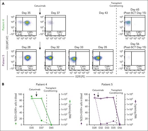 Cetuximab treatment to deplete CAR-37 T cells via tEGFR. (A) Flow cytometry dot plots of CD3+EGFR+ cells in peripheral blood at the indicated time points. Patients 4 and 5 who experienced bone marrow aplasia at day 27 after CAR-37 therapy were treated with cetuximab on day 28 (patient 5) or day 35 (patient 4) to deplete their CAR-37 T cells (indicated by the arrows). On day 35 (patient 5) or day 43 (patient 4), the patients were treated with transplant conditioning chemotherapy and underwent a HSCT (indicated by the dashed line). The post-HSCT flow plots are also shown. (B) The percentage of CD3+EGFR+ cells in peripheral blood (left axis, bar graphs) in comparison with the VCN, reported as copies per microgram of DNA, detected by PCR in peripheral blood (right y-axis, line graphs) at the indicated time points is shown. Arrows indicate the timing of cetuximab treatment. The dashed line indicates the timing of the transplant conditioning treatment as shown in panel A.