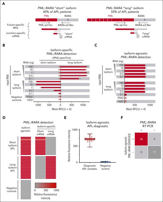 Design and validation of PML::RARA SHERLOCK assay for APL. (A) Illustration of PML::RARA target-specific assay design strategy with “fusion-specific” RT-RPA primers and “junction-specific” crRNA guides. (B) LOD for isoform-specific PML::RARA RNA. (C) LOD for isoform-agnostic PML::RARA RNA. (D) Heat map illustrating background-subtracted fluorescence intensity for isoform-specific and isoform-agnostic APL PML::RARA SHERLOCK using RNA extracted from patient samples. (E) Background-subtracted fluorescence from isoform-agnostic APL PML::RARA SHERLOCK performed on diagnostic PML::RARA RT-PCR–positive samples (n = 36) and control samples (n = 17). (F) Summary concordance of isoform-agnostic APL PML::RARA SHERLOCK and PML::RARA RT-PCR. RFU, relative fluorescence units.