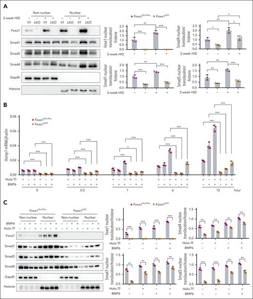 Foxo1 ablation impairs the response of hepcidin signaling to iron. (A) Nuclear Foxo1, Smad1, Smad4, and Smad5 were measured in the primary hepatocytes from 8-week-old male Foxo1LKO and Foxo1flox/flox mice receiving normal or a 2-week HID (left). Quantification of the nuclear Foxo1, Smad1, Smad4, and Smad5 proteins (right). (B) Primary hepatocytes from 8-week-old male Foxo1LKO and Foxo1flox/flox mice were treated with holo-Tf and/or BMP6; hepcidin (Hamp1) mRNA expression was measured by qPCR at indicated time point. (C) Primary hepatocytes from 8-week-old male Foxo1LKO and Foxo1flox/flox mice were treated with holo-Tf and/or BMP6 for 7 hours; the nuclear translocation of Foxo1, Smad1, Smad4 and Smad5 were measured by nucleocytoplasmic separation (left) and quantified (right). The concentration of holo-Tf was 30 μM and BMP6 was 20 ng/mL. Results from qPCR were obtained from 3 biological replicates. Quantification of western blot was obtained from 3 independent experiments. ∗P < .05; ∗∗P < .01; ∗∗∗P < .001. The P value was calculated by the 1-way ANOVA with the Sidak multiple comparison test. (B) Multiple comparison test was performed in groups with the same treatment duration. (C) Multiple comparison test was performed in groups with the same treatment condition.