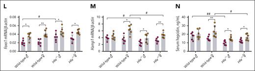 Hepatocyte-specific Foxo1 overexpression alleviates iron overload in Hfe−/− mice. (A) A scheme to illustrate the validation of specificity of pLIVE-Foxo1-AAA in vivo. Four-week-old male Hfe−/− mice received a single tail vein injection of 200 μg pLIVE-Foxo1-AAA or an empty vector for 2 weeks (n = 3 mice in each group). (B-D) In the primary hepatocytes from Hfe−/− mice receiving 200 μg pLIVE-Foxo1-AAA or an empty vector for 2 weeks, Foxo1 mRNA (B), Hamp1 mRNA (C), Foxo1 protein, and pSmad1/5/8 (D) were measured. (E) The expression specificity of pLIVE-Foxo1-AAA was analyzed in the hepatocytes and nonhepatocytes from Hfe−/− mice receiving 200 μg pLIVE-Foxo1-AAA or an empty vector for 2 weeks (left). The nuclear Foxo1, Smad1, Smad4, and Smad5 in hepatocytes and nonhepatocytes were quantified (right). Quantification of western blot was obtained from 3 independent experiments. (F) A scheme to illustrate the validation of effectiveness in reducing iron overload in vivo. Four-week-old WT and Hfe−/− mice received the tail vein injection of 200 μg pLIVE-Foxo1-AAA or an empty vector at ages 4 and 5 weeks, respectively (2 times, 200 μg each time). Mice were euthanized at age 8 weeks (n = 6 in each group). (G-N) Iron-related phenotypes of WT and Hfe−/− mice received pLIVE-Foxo1-AAA or an empty vector treatment in panel F. (G-J) Liver nonheme iron (G), serum iron (H), transferrin saturation (I), and spleen nonheme iron levels (J) were measured. (K) Perls iron staining of the liver and spleen tissues. (L-N) Liver end point Foxo1 mRNA (L), Hamp1 mRNA (M), and serum hepcidin levels (N) were measured in WT and Hfe−/− mice receiving pLIVE-Foxo1-AAA or an empty vector in panel F. WT and Hfe−/− mice were C57BL/6J background. ∗P < .05; ∗∗P < .01; ∗∗∗P < .001. The P value was calculated by the Student t test for 2 group comparison or the 1-way ANOVA with the Sidak post hoc test for multiple comparisons in sex- and genotype-matched data. #P < .05; ##P < .01; ###P < .001. The P values were calculated by the 1-way ANOVA with the Sidak post hoc test for multiple comparisons between WT mice and Hfe−/− mice in sex-matched data.
