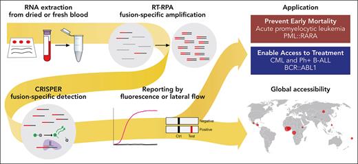 SHERLOCK is a novel, highly sensitive and specific test for the detection of fusion-driven leukemia transcripts. It can be performed outside of molecular laboratories as a POC test and promises to be useful for the fast and reliable diagnosis of fusion-driven leukemias in low-resource environments. RT-RPA, reverse transcription and recombinase polymerase amplification. Professional illustration by Patrick Lane, ScEYEnce Studios.