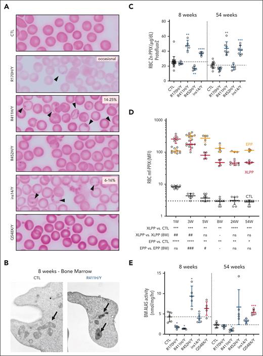 Siderocytes and mf-PP in XLSA and XLPP mouse models. (A) Representative photomicrographs of Perls iron-stained peripheral blood smears of control, XLSA, and XLPP males at age 8 weeks. Arrows indicate siderocytes. The range of siderocyte frequency is indicated in the upper right of each image. Original magnification, 1000×. (B) Representative transmission electron micrographs of reticulocytes from wild-type and p.R411H mice at age 8 weeks. Note the electron-dense deposits in the p.R411H mitochondria. Original magnification, 20 000×. (C) RBC Zn-PPIX determined by hematofluorometry. (D) RBC mf-PPIX mean fluorescence intensity (MFI) determined by flow cytometry. (E) ALAS activity in control, XLSA, and XLPP mutant BM determined in vitro. The dotted line in each panel indicates the average value in control animals. For all panels, n = 3 to 10 animals per group. ∗P < .05; ∗∗P < .01; ∗∗∗P < .001; ∗∗∗∗P < .0001, compared with control animals at the same age. #P < .05; ##P < .01; ###P < .001; ###P < .0001, compared with the same mutant animals at 8 weeks. CTL, control.