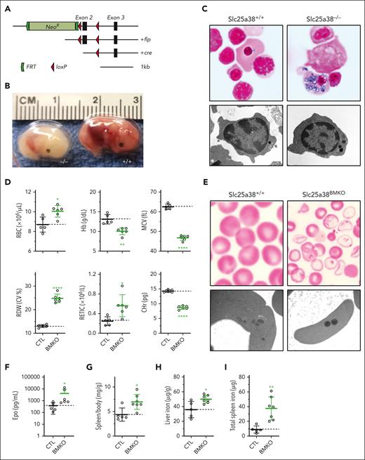 Murine Slc25a38 deficiency phenotype. (A) Slc25a38 gene targeting strategy. (B) Germ line Slc25a38-deficient E14.5 embryos show extreme pallor compared with the control. (C) Perls iron-stained peripheral blood smears (top; original magnification, 1000×) and transmission electron micrographs (TEMs) of peripheral blood (bottom; original magnification, 17 700×) from E14.5 embryos demonstrating iron-positive granules in mutant nucleated fetal erythrocytes confirmed to be electron-dense material within mitochondria by TEM. (D) RBC indices of control Slc25a38fl/− and Slc25a38fl/−; Vav1-cre+ (Slc25a38BMKO) animals. (E) Perls iron-stained peripheral blood smears (top; original magnification, 1000×) and TEMs of peripheral blood (bottom; original magnification, 22 000×) from 8-week-old animals demonstrating iron-positive granules in mutant erythrocytes confirmed to be electron-dense material within mitochondria on TEM. (F-I) Spleen-to-body mass ratio (F), EPO (G), liver iron (H), and splenic iron (I) in 8-week-old animals. For all panels, n = 5 or 6 mixed males and females in each group, aged 8 weeks, fed conventional mouse chow. The dotted line in each panel indicates the average value in control animals. ∗P < .05; ∗∗P < .01; ∗∗∗P < .001; ∗∗∗∗P < .0001, compared with control animals.