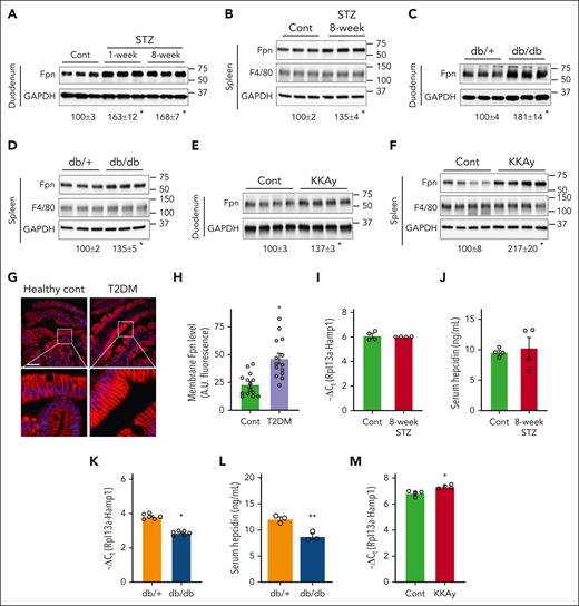 Upregulation of Fpn expression in diabetic mice and humans. (A,C,E) Fpn protein expression in the duodenum and (B,D,F) spleen of (A-B) STZ-treated mice, (C-D) db/db mice, and (E-F) KKAy mice, with glyceraldehyde-3-phosphate dehydrogenase (GAPDH) as an internal control. The percentages of change in Fpn expression (underneath the blots) in diabetic mice over the control are shown as mean ± SEM (n = 6 for panels A-D, and n = 4 for panels E-F). (G) Representative Fpn staining of the duodenum of type 2 diabetic (T2DM) and human patients who are nondiabetic. (H) Quantified arbitrary fluorescent intensity of membrane Fpn in T2DM and control patients. Data are mean ± SEM (n = 14 human patients). For each duodenal sample, fluorescent signal was measured in 10 representative cells by ImageJ and the average was obtained. Liver Hamp1 mRNA expression was determined by quantitative reverse transcription polymerase chain reaction in (I) STZ-treated mice, (K) db/db, and (M) KKAy mice. Serum hepcidin content was determined in (J) STZ-treated and (L) db/db mice by enzyme-linked immunosorbent assay. ∗P < .01 and ∗∗P < .05 compared with the corresponding controls. Bar, 50 μm.