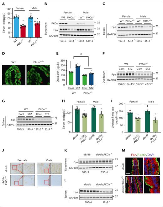 Deficiency in PKCα downregulates Fpn expression in physiology and diabetes. (A) Serum iron and Fpn expression in the (B) duodenum and (C) spleen were determined in 16-week-old female and male PKCα−/− vs WT mice. Immunoblotting for PKCα shows the successful deletion of PKCα in PKCα−/− mice. (D) Representative confocal images show the localization of Fpn in the duodenum of WT and PKCα−/− male mice. Arrow, membrane Fpn expression; arrowhead, intracellular Fpn. (E) Serum iron and Fpn expression in the (F) duodenum and (G) spleen were determined in WT and PKCα−/− male mice with and without STZ-induced diabetes. (H) Serum iron was determined in female and male db/db and db/db;PKCα−/− mice. Liver iron content was determined in db/db and db/db;PKCα−/− mice by (I) biochemical assay and (J) Perls iron staining. Fpn protein expression was determined in the (K) duodenum and (L) spleen of db/db and db/db;PKCα−/− female mice. (M) Confocal images showing Fpn (red) localization in the enterocytes of db/db and db/db;PKCα−/− mice, with F-actin staining (green) as a marker of the cytoskeleton. Data are shown as mean ± SEM (n = 5-10). ∗∗P < .05 and ∗P < .01 compared with their WT controls. #P < .01 comparing the percentages of differences between WT and PKC−/− mice. &P < .01 compared with the WT control (WT-Cont) group. Bars, 50 μm.