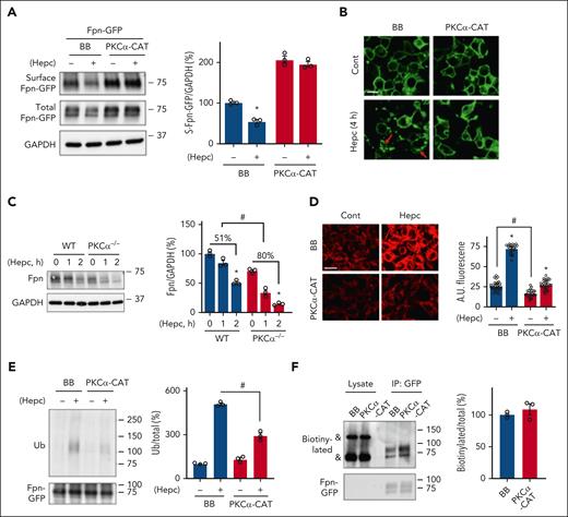 PKCα counteracts hepcidin-induced ubiquitination and internalization of Fpn. 293T cells were transfected with Fpn-GFP together with BB or PKCα-CAT. The transfected cells were then treated for 4 hours with and without 0.5 μg/mL human hepcidin (Hepc). (A) Surface Fpn expression and (B) subcellular Fpn localization were determined by surface biotinylation assay and confocal microscopy, respectively. Surface Fpn-GFP was detected with 20% of the biotin/streptavidin pulldown from 300 μg total proteins. Red arrow denotes intracellular Fpn-GFP. (C) WT and PKCα−/− BMDMs were treated for 1 or 2 hours with 0.25 μg/mL mouse hepcidin, and Fpn expression was determined by immunoblotting with anti-mouse Fpn antibody. (D) 293T cells were transfected with BB or PKCα-CAT. The transfected cells were treated for 24 hours with and without 0.5 μg/mL human hepcidin, followed by determining intracellular labile Fe2+ content with 1 μM FerroOrange. The arbitrary fluorescent intensity was then quantified (n = 30 cells of 3 independent experiments). (E) TRex cells were transfected with BB or PKCα-CAT, and the expression of Fpn-GFP was induced overnight by 100 ng/mL Dox. Dox-induced cells were/were not treated for 2 hours with 0.5 μg/mL hepcidin, followed by immunoprecipitation of Fpn-GFP with anti-rabbit GFP antibody. The ubiquitination level of Fpn-GFP was determined with anti-ubiquitin FK2 antibody, and the total amount of immunoprecipitated Fpn-GFP was determined with anti-mouse GFP antibody. (F) Dox-treated TRex cells that were transfected with BB or PKCα-CAT were incubated for 30 minutes with 3 μg/mL biotinylated human hepcidin. After immunoprecipitation with anti-rabbit GFP antibody, the abundance of coimmunoprecipitated biotinylated hepcidin was determined with horseradish peroxidase–conjugated streptavidin. “&” denotes nonspecific bands. Data are shown as mean ± SEM of 3 independent experiments. ∗P < .01 compared with the untreated controls; #P < .01. Bar, 10 μm.