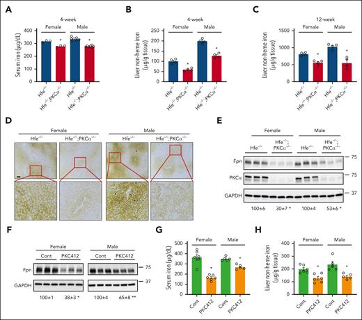 The loss-of-function of PKCα mitigates iron overload in hereditary hemochromatosis. (A) Serum iron level was measured in female and male Hfe−/− and Hfe−/−; PKCα−/− mice (4 weeks old). Liver nonheme iron content was measured in female and male Hfe−/− and Hfe−/−; PKCα−/− mice at (B) 4 and (C) 12 weeks of age. (D) Perls iron staining shows iron deposition in the liver of female and male Hfe−/− and Hfe−/−; PKCα−/− mice. (E) Duodenal Fpn expression in female and male Hfe−/− and Hfe−/−; PKCα−/− mice by immunoblotting with anti-mouse Fpn antibody. (F-H) Female and male Hfe−/− mice were fed an iron-deficient diet from when they were born until 3 weeks of age. Mice were then transferred onto chow diet and receive PKC412 (50 mg/kg body weight) or vehicle for 2 weeks. (F) Duodenal Fpn expression and (G) serum and (H) liver iron content were determined. Data are expressed as mean ± SEM (n = 3-7). ∗P < .01; and ∗∗P < .05 compared with Hfe−/− mice or the corresponding controls. Bar, 100 μm.