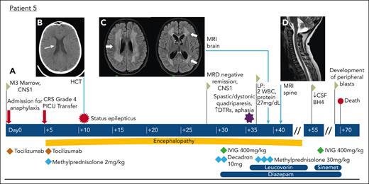 Visual vignette describing development of paresis in 1 patient with brain abnormalities only on neuroimaging. Patient 5: (A) Time line of clinical course. (B) Head computed tomography showing mild lateral ventricle prominence (thin white arrow), but no short-term change. (C) Axial FLAIR images from MRI of the brain showing extensive bilateral areas of abnormal T2 signal intensity involving the white matter of the centrum semiovale, superior corona radiata, and periventricular white matter (thick white arrows), associated with restricted diffusion centrally, but no enhancement (diffusion-weighted and gadolinium-enhanced imaging not shown). (D) Sagittal T2 image from MRI of the spine with normal findings. DTR, deep tendon reflex; PICU, pediatric intensive care unit.