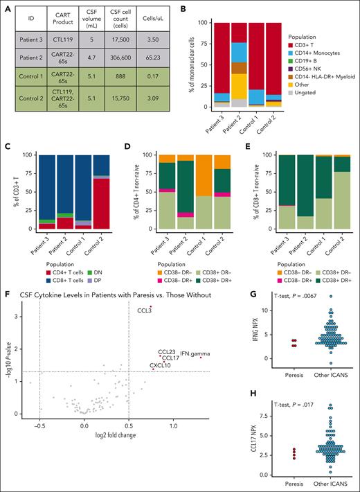 Correlative studies of cellular populations and proteins from CSF demonstrate a marked absence of inflammatory signature. (A) CSF volume and cell counts for 2 patients with spinal paresis after CART at the time of symptoms and 2 patients who received CART but did not develop symptoms of ICANS. Proportion of cell types determined by flow cytometry of each lineage distribution (B) and T-cell distribution (C) were similar between all 4 patients. Proportion of CD4 (D) and CD8 (E) cells with flow cytometry evidence of activation were similar between all 4 patients. (F) Volcano plot (adjusted P > .05, log fold change >0.5) demonstrating differentially expressed proteins measured from D28 CSF in patients who developed quadriparesis or paraparesis (N = 4) and patients treated with CART19 or CART22 who did not (N = 150). The top 2 differentially expressed proteins were interferon gamma (G) and CCL17 (H), and were lower in patients who developed paresis (N = 4) than in those who developed any other phenomenology of ICANS (N = 78). ID, identifier.
