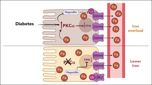 PKCα is a novel regulator of Fpn in diabetes. Diabetic hyperactivation of PKCα upregulates intestinal Fpn expression in a hepcidin-independent manner. PKCα decreases endocytic trafficking of Fpn and suppresses hepcidin-induced ubiquitination, and degradation of Fpn. Inhibition or genetic disruption PKCα alleviates iron overload. Fpn, ferroportin; PKCα, protein kinase C alpha.