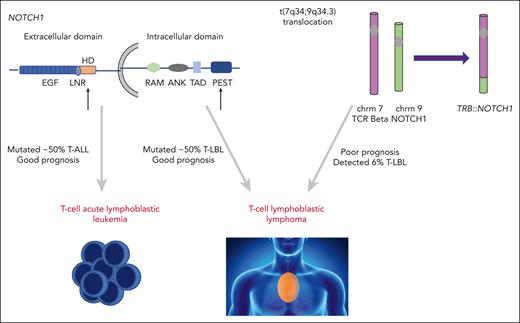 Activating NOTCH1 mutations occur in over 50% of T-ALL and T-LBL cases. The majority of these occur in the heterodimerization or PEST domain (black arrows) and are associated with favorable outcomes in T-ALL and T-LBL. The translocation of NOTCH1 gene to TRB locus t(7;9) results in aberrant NOTCH activation. te Vrugt et al show this fusion is identified in T-LBL, but not T-ALL, and its presence correlates with higher relapse risk. chrm, chromosome; TCR, T-cell receptor.