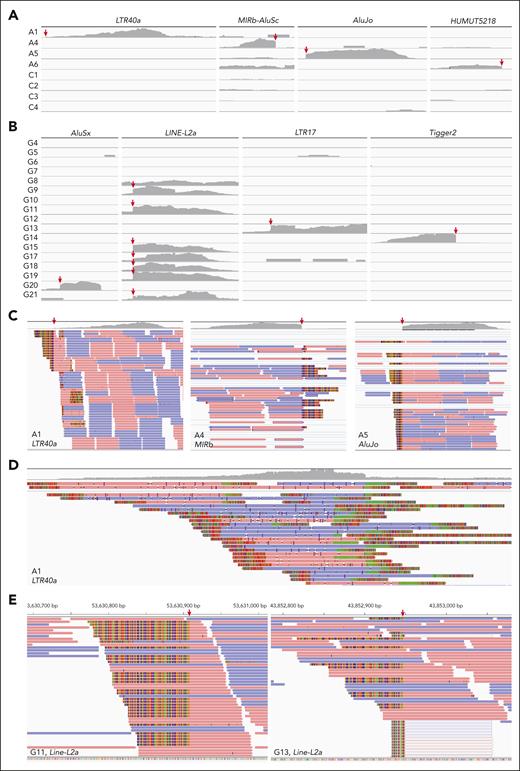 Expression analysis of TEs. (A) Alignment coverage tracks of short-read WTS reads in RARA-aAPL cases with available data according to each implicated TE, visualized using the IGV version 2.3.92. Red arrows indicate the splicing sites. C1-4 were PML::RARA positive APL cases serving as controls. (B) Alignment coverage tracks of short-read WTS reads in RARG-aAPL cases according to each implicated TE. (C) Reads alignment tracks (lower) and alignment coverage tracks (upper) of short-reads WTS reads in RARA-aAPL cases at each implicated TE locus. (D) Reads alignment tracks (lower) and alignment coverage tracks (upper) of long-read WTS reads at the implicated LTR40a locus in the index case A1. (E) Reads alignment tracks of short-read WTS reads in example cases G11 and G13 at the LINE-L2a loci.