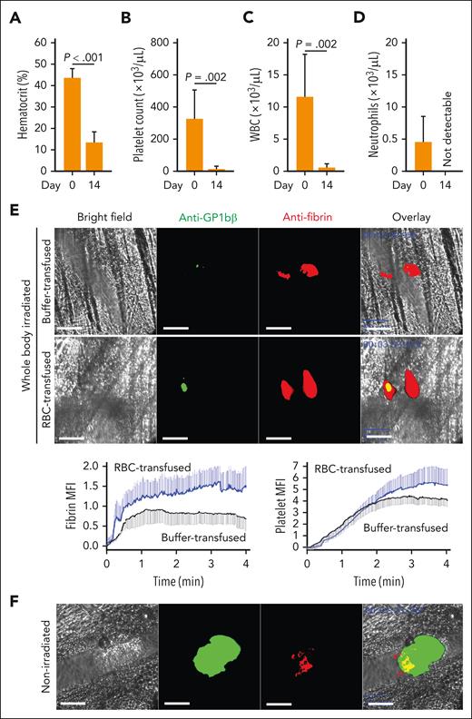 Hemostasis at the site of laser-induced injury. Mice subjected to 6.5 Gy total body irradiation had significantly reduced hematocrit (A), platelet count (B), white blood cell (WBC) count (C), and neutrophil count (D) (n = 6, paired t test). (E) Top panels: Representative images of platelet aggregation identified by Dylight 488 anti-GPIbβ antibody (green) and fibrin clot formation detected by Alexa Fluor 647 anti-fibrin antibody (red) in response to a penetrating vascular injury induced by pulse laser in cremaster arterioles of irradiated mice with or without RBC transfusion (bar = 50 μm); bottom panels: time-dependent changes in the formation of platelet and fibrin clots quantified using mean fluorescence intensity (MFI) of antibody-bound fibrin (left) and platelets (right) from 11 independent experiments (6 transfused with RBCs and 5 with cell-free plasma; 2-way ANOVA, P < .001) (bottom). (F) Representative images of platelet and fibrin hemostatic plugs at the site of an identical laser injury to nonirradiated C57BL/6J mice (bar = 50 μm).
