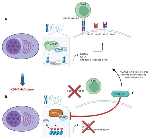 KDM6A controls genes related to immune response in MM. (A) Dupéré-Richer et al show that KDM6A regulates transcription of MHC’s master regulatory genes CIITA and NLRC5 in multiple myeloma cells by promoting acetylation of enhancers. (B) KDM6A deficiency results in decreased MHC’s expression and T-cell infiltration. (C) HDAC3 inhibitor reinstates acetylation of histones together with MHC expression in KDM6A-deficient MM cells.