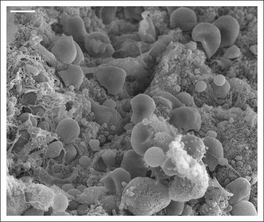 Despite being a prominent feature in blood clots, RBCs have an underappreciated role in hemostasis. Scanning electron microscopy image of an arterial thrombus. Scale bar = 4 μm.