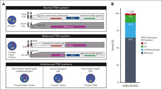 Patterns of MYC break-apart FISH probe signals and their proportions in HGBCL-DH-BCL2. (A) Representative MYC break-apart FISH patterns. When the MYC locus is undisturbed, the red (centromeric) and green (telomeric) signals are in close proximity and produce a fused signal. An example of a rearrangement producing a balanced break-apart pattern is depicted using MYC and IGH as example loci. (B) Frequency of break-apart FISH patterns observed in 297 HGBCL-DH-BCL2 tumors. Balanced represents equal number of break-apart probe signals, whereas unbalanced gain indicates that both red and green break-apart signals are present but not equal in numbers.