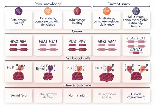 In complete α-globin deficiency, erythrocytes carry hemoglobin Bart’s (γ4 tetramer), which does not effectively deliver oxygen, leading to the BHFS and resulting in fetal demise. Here Chappell et al report a novel conditional mouse model of severe α-thalassemia based on a floxed α-globin allele, ex vivo Cre delivery to HSCs by LNPs, and hematopoietic transplant. In these animals with complete α-globin deficiency in the adult stage where erythrocytes carry nonfunctional Hb H (β4 tetramer), erythrocytosis and tissue hypoxia preceded lethality, which could be rescued by a novel α-globin lentiviral vector. Professional illustration by Somersault18:24.
