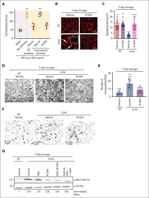 Reversibility of G04-mediated inhibition of RHOA allows clotting activity of platelets in vivo and prevents cold storage–associated deficiencies in adhesion, formation of microparticles, and myosin light chain (MLC) activation. (A) Tail bleeding time analysis in C57BL/6 mice. C57BL/6 mice were sublethally irradiated (2.5 Gy), administered aspirin 1 week later, treated with aspirin, and 24 hours later transfused with either RT or 7-day cold-stored congenic platelets stored in plasma with or without R-G04 (75 μM). Data are derived from 2 independent experiments with 5 mice per group. (B) Representative example of human platelet spreading on fibrinogen, and confocal microscopy of phalloidin-stained specimens. Cold-stored platelets were stored in either vehicle or G04 for 7 days. Arrows depict platelet aggregates. The white outlined square highlights a representative area of platelet singlets. (C) Quantification of measurement of platelet spreading in panel B. A minimum of 20 platelets per group were analyzed and averaged from 2 independent experiments. (D) Representative example of electron micrograph sections (1500× original magnification) of platelets stored at RT with vehicle or in cold conditions with or without R-G04. Arrows depict microparticles of variable sizes, <1 μm in diameter. Magnification bar = 5 μm. (E) Quantification of microparticle content of platelets stored at RT in vehicle or after cold storage with or without R-G04. A minimum of 10 fields similar to the ones presented in panel D were analyzed and averaged from 2 biological replicates. (F) Transmission electron microscopy analysis of 7-day RT-stored platelets in vehicle control or stored in cold conditions with or without R-G04 (10 000× larger images and 1500× original magnification insets). Arrows depict dilated cisterns in platelets stored in cold conditions in the absence of R-G04, which were not evident in cold-stored platelets in the presence of R-G04 or in platelets stored at RT. Magnification bar = 0.1 μm. (G) Representative example of immunoblot analysis of 7-day cold-stored human platelets blotted for phosphorylated MLC (Ser19; p-MLC) showing that cold storage induces p-MLC, which can be prevented by RHOA and RAC inhibition. Density quantification was performed using ImageJ software, and ratios were calculated after normalization of the RT-vehicle control. Data were reproduced in at least 2 independent experiments. ∗∗∗P < .001.