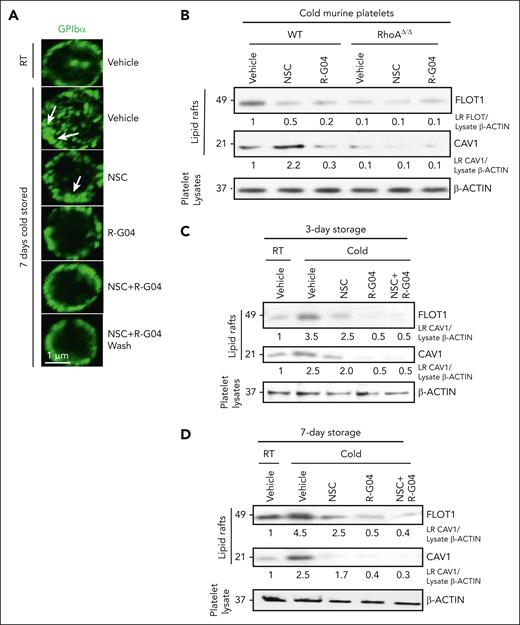 Cold storage of platelets induces abnormal membrane distribution of GPIbα and lipid raft formation, which can be prevented by RHOA inhibition. (A) Human GPIbα analysis by confocal microscopy (magnification bar = 1 μm). The green color shows GP1B expression. Arrows represent areas of abnormally distributed membrane GPIbα. (B) Representative example of immunoblot analysis of cold-stored platelets from WT and RhoAΔ/Δ mice treated with either RHOA inhibitor, RAC inhibitor, or both for Cav1 and Flot1, showing induction of lipid rafts upon cold storage. This induction can be prevented by the RHOA and RAC inhibitors. (C) Representative example of immunoblot analysis in purified lipid rafts (Triton X-100/sucrose gradient) of 3-day cold-stored human platelets analyzed for the expression of FLOT1 and CAV1. (D) Representative example of immunoblot analysis in purified lipid rafts (Triton X-100/sucrose gradient) of 7-day cold-stored human platelets analyzed for the expression of FLOT1 and CAV1. Density quantification was performed using ImageJ software, and ratios were calculated after normalization of the RT-vehicle control. Data were reproduced in at least 2 independent experiments.