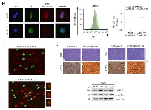 Enrichment analysis and validation of the unfolded protein response (UPR) system’s modulation. (A) Image adapted from Kyoto Encyclopedia of Genes and Genomes (KEGG) analysis (full image is provided in supplemental Figure 18) of differentially expressed genes in RP11-350G8.5 KO ABZB cells revealing a network of genes involved in the UPR in endoplasmic reticulum (ER). (B-F) Western blot (WB) analysis conducted on proteins extracted from ABZB and AMO-1 GFP+ sorted cells after RP11-350G8.5 KO, or overexpression (UP) or transduced with the SCRAMBLE vector, or following bortezomib treatment. (G) Distribution of SCRAMBLE and KO ABZB and AMO-1 cells stained with annexin V/7AAD to assess the percentage of apoptosis following the KO. The fold increase of annexin V+/7AAD+ late apoptotic events was 2.7 for ABZB KO cells and 1.8 for AMO-1 KO cells, compared with SCRAMBLE-transduced cells. (H, left) Representative images from a FISH analysis conducted with the probe targeting the lncRNA RP11-350G8.5 conjugated with TAMRA dye (red signal) and the antibody against CRT protein, whose secondary antibody is conjugated with FITCH (green signal). Images were acquired with a DMI6000-AF6000 Leica microscope (magnification ×63). (H, right) Membrane expression of CRT on ABZB cells transduced with SCRAMBLE (gray curve) or KO vector (green curve), detected through flow cytometry (7AAD-negative cells were gated to exclude dying cells from this analysis). The fold change of the median fluorescent intensity (MFI) was calculated to quantify the increase of CRT exposure to the cell membrane following KO, with respect to scramble cells. (I) Representative images of immunofluorescent assay show ABZB tumor cells in green and monocyte-derived dendritic cells (MoDCs) in red. After RP11-350G8.5 KO, there is an evident increase of cancer cells engulfed in MoDCs, as indicated by arrows. (Enlarged images of phagocytosed cells are reported near the pictures with magnification ×20.) The images were obtained with a DMI6000-AF6000 Leica microscope. A quantification of engulfed cells following KO was provided by a flow cytometric analysis (supplemental Figure 19). (J) Hematoxylin and eosin (H&E) and p-PERK immunohistochemistry staining of retrieved tumors from animals engrafted with ABZB SCRAMBLE or ABZB RP11-350G8.5 KO cells revealed the high grade of engrafted tumors, based on histologic evaluation of nuclear atypia, necrosis, and mitotic pattern. Visualization was performed with a Leica DM 2500 optical microscope (magnification ×20) (upper panel). WB analysis of p-PERK and the downstream effector p-eIF2 α on whole protein extracted from tumors retrieved from mice 16 days after engraftment (lower panel).