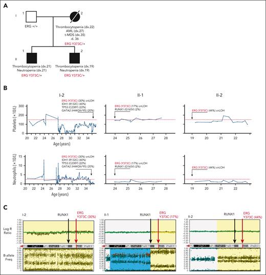 Germ line ERG variant identified in a family with hematological conditions. (A) Pedigree of family 1 containing the ERG (Y373C) variant that segregates with thrombocytopenia and AML. Age of onset (years). (B) History of platelet and neutrophil counts of affected family members (patient 15, 16, and 17) (I-1, II-1, and II-2). Absolute neutrophil or platelet counts per microliter of blood from complete blood examinations plotted with age (years). Normal lower limit for neutrophils and platelets is marked with a dotted red line. (C) Log R ratio and B-allele plots of single-nucleotide polymorphism–array analysis. All individuals show a cnLOH event that encompasses the entire ERG gene (yellow highlight). Individual II-1 (patient 16) had a second cnLOH event (blue highlight). Log R ratios (top panels) show no loss of copy number, and B-allele frequencies (bottom panels) show regions of LOH, together demonstrating cnLOH. Samples used: patient I-2, BM cytogenetic pellet; II-1 and II-2, PB mononuclear cells. d, died; dx, diagnosed.