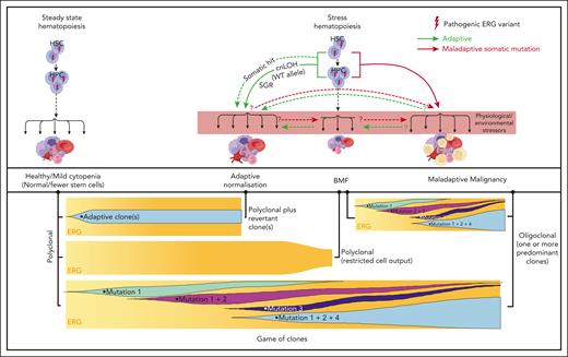 Proposed model for ERG deficiency syndrome–associated phenotypes showing adaptive/maladaptive events in ERG heterozygous carriers. It is proposed that ERG carriers harbor a threshold of activity that is insufficient under certain physiological and environmental stressors, thus leading to a range of phenotypic outcomes (top panel). Malignant cells (yellow cells). Maladaptive and adaptive events observed in our study (arrow). Other potential (maladaptive/adaptive) somatic events seen in other BMF and/or HM predisposition genes63-65 (dotted arrow) or hypothetical events (question mark preceding dotted arrow). Game of clones (bottom panel). The development of different physiological outcomes in patients is the consequence of a game of clones in which context-dependent competitive fitness of the clone(s) determines progression and the observed outcome. Notably, adaptive and maladaptive events and subsequent clonal selection may occur simultaneously. The clonal output shown is based on mature blood cells, reflecting collectively the impact on mature and stem and progenitor cells.