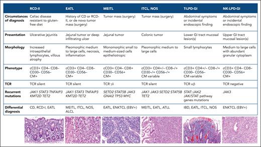 Differential diagnosis of T-cell lymphomas and T/NK-cell LPDs in the gastrointestinal tract (modified from de Leval et al82). CD, celiac disease; CM, cytotoxic molecules; EBV, Epstein-Barr virus; ENKTCL, extranodal NK/T-cell lymphoma, nasal type; IBD, inflammatory bowel disease; ITCL, NOS, intestinal T-cell lymphoma, not otherwise specified; NK-LPD-GI, indolent NK-cell LPD of the gastrointestinal tract; RCD, refractory CD; T-LPD-GI, indolent clonal T-cell LPD of the gastrointestinal tract (ICC), indolent T-cell lymphoma of the gastrointestinal tract (WHO5).