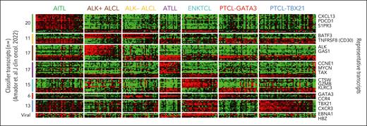 Gene expression–based molecular predictor for major PTCL entities. Amador et al107 used gene expression profiling for major PTCL subsets to differentiate each PTCL subtype including the novel molecular subtypes (PTCL-GATA3 and PTCL-TBX21). Shown are the expressions of known distinct transcripts for each patient in a molecular PTCL subtype (the detailed characteristics of these transcripts have been described in Amador et al107). Key histopathological features and immunohistochemistry biomarkers for each PTCL entity are shown under each molecular subtype.