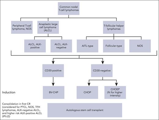 Current frontline treatment for common nodal PTCL. Treatment of patients with nodal PTCL eligible for curative therapy. In the absence of a clinical trial, patients with ALCL and CD30-positive PTCLs receive induction therapy with BV-CHP. Patients with CD30-negative PTCL receive CHOEP (if eligible for intensive therapy) or CHOP. We offer consolidation with ASCT in the first CR for fit patients with higher-risk ALK-positive ALCL (International Prognostic Score of ≥2) and those with other common nodal PTCL entities.