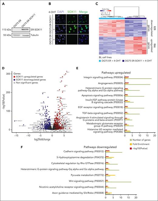 Gene expression analysis upon SOX11 overexpression in DG75-ER-SOX11 BL cell line. (A) Western blot experiment showing the levels of ER-SOX11 protein in DG75 ER-SOX11 BL cell line. DG75-ER was used as SOX11-negative control cell line, and tubulin as loading control. (B) Immunofluorescence experiments showing the nuclear localization of the SOX11 protein in DG75 ER-SOX11 cells, induced (+) or not induced (−) with 4-OHT for 24 hours. DG75 ER cell line was used as SOX11− control. DAPI (4′,6-diamidino-2-phenylindole) marks the cellular nucleus, and a merge of the 2 immunofluorescences images (DAPI and SOX11) was done. (C) Heat map illustrating the scaled expression (Z score) of 1694 DEGs (866 upregulated and 828 downregulated genes; supplemental Table 7) in DG75 ER-SOX11 compared with DG75 ER cell lines induced with 4-OHT for 8 and 24 hours, obtained by RNA-seq. Genes with an adjusted P value <.1 and absolute log2-transformed fold change of >0.65 were considered. (D) Volcano plot showing genes differentially expressed, obtained by RNA-seq, upon SOX11 overexpression in DG75 ER-SOX11 compared with DG75 ER BL cell lines treated with 4-OHT. The graph shows on the y-axis –log10(P value) and on the x-axis the log2-transformed fold change. Genes upregulated and downregulated in DG75 ER-SOX11 vs DG75 ER with an adjusted P value <.1 and log2-transformed fold change of >0.65 or less than −0.65 are colored in red and blue, respectively, and genes with an adjusted P value <.00005 and absolute log2-transformed fold change of >3 are labeled with their gene symbol. (E-F) Panther pathway enrichment analysis using DEGs (E) upregulated and (F) downregulated between DG75 ER-SOX11 and DG75 ER after 4-OHT treatment. Number of genes, fold enrichment, and –log10(P value) for each pathway are shown. Only pathways with a P value <.05 were considered.