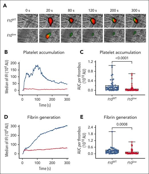 Reduced thrombus formation in f10low mice in laser–induced vessel injury model. A localized laser injury was induced in the cremaster arterioles of f10WT (n = 4) or f10low (n = 4) mice. Clot formation was visualized by monitoring the accumulation of platelets and the deposition of fibrin. Platelets (red) and fibrin (green) were detected using AlexaFluor647-conjugated anti-GPIb and Alexa Fluor 488-conjugated antifibrin antibodies, respectively. (A) Representative digital composite fluorescence and bright-field images of platelet accumulation (red) and fibrin deposition (green) in f10WT (n = 46 clots) and f10low (n = 44 clots) mice before (0 s) and 20, 80, 120, 200, and 300 s after laser injury. (B,D) Kinetic curves displaying platelet accumulation and fibrin deposition in f10WT (blue; 46 clots) and f10low (red; 44 clots) mice. Plotted is median IFI for platelets (B) and fibrin (D) fluorescence vs time after injury. (C,E) Distribution of the integrated platelet (C) or fibrin (E) fluorescence intensity for each of the 46 clots in f10WT mice and 44 clots in f10low mice. Plotted is the AUC for each individual thrombus. Presented are Box-Whisker plots with minimum to maximum values, with all individual data points shown. Statistical analysis was performed using the Mann-Whitney test. AUC, area under the curve; IFI, integrated fluorescence intensity.