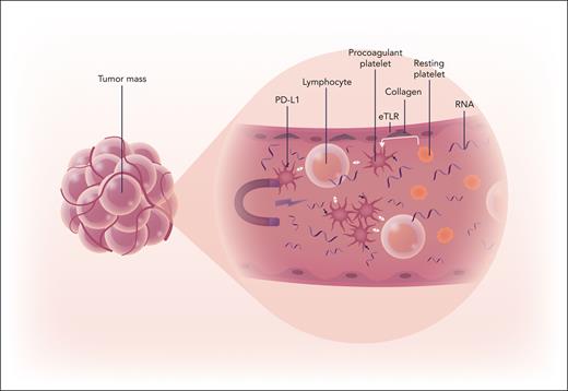 Platelets are attracted into the tumor vasculature by nucleic acids (RNA), where they become activated to procoagulant platelets, which deliver IC molecules and recruit immune cells to promote tumor growth. Professional illustration by Somersault18:24.