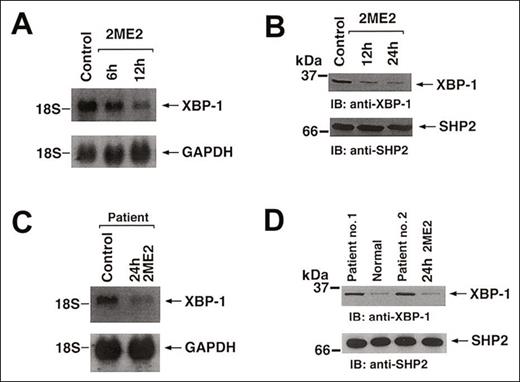Effect of 2ME2 on XBP-1 expression. MM.1S cells were treated with 3 μM 2ME2 for the indicated times. (A) Total cellular RNA was subjected to Northern blot analysis. Data shown is representative of 3 independent experiments with similar results. (B) Total cell lysates were separated by 12.5% SDS-PAGE and analyzed by immunoblotting (IB) with anti–XBP-1 (upper panel) or anti-SHP2 (lower panel) Abs. (C) Purified patient MM cells (CD138+) were treated with 2ME2 for the indicated times and analyzed for mRNA levels by Northern blotting. The blots were reprobed with GAPDH to confirm equal loading. (D) Total cell lysates from purified MM cells (CD138+) (patient 1 and patient 2), normal BM cells, and 2ME2-treated patient cells were separated by 12.5% SDS-PAGE and analyzed by immunoblotting (IB) with anti–XBP-1 (upper panel) or anti-SHP2 (lower panel) Abs.