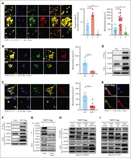 P-YAP1 facilitates cytoskeletal activation by binding its WW2 domain to MYH9. (A) Confocal images of MKs treated with a YAP1 activator (XMU-MP-1, X) or YAP1 inhibitor (Peptide 17, P) after immunostaining for tubulin (green, tubulin), F-actin (yellow, phalloidin), and MKs (red, CD41). Scale bar, 10 μm. Proplatelet formation is indicated by the red arrows. Assessment of percentage of stress fiber formation (middle) and spreading area (right) in the 3 groups (n ≥ 5). (B) Confocal images of MKs from patients with ITP and healthy controls after immunostaining for YAP1 (green, YAP1), F-actin (yellow, phalloidin), and MKs (red, CD41). Scale bar, 10 μm. Right: analysis of the MK spreading area in the ITP group vs the control group (n = 10). (C) MKs were isolated from WT and YAP1+/− mice to observe the cytoskeleton (left) and the spreading area (right; n = 10). (D) Coimmunoprecipitation assay to verify the interaction between YAP1 and MYH9 (n = 3). (E) Confocal images of PCDH-YAP1-flag-DAMI (YAP1-flag) after immunostaining for MYH9 (yellow, MYH9) and YAP1 (red, CD41). Scale bar, 10 μm. (F) P-YAP1 binding to MYH9 was confirmed by coimmunoprecipitation using flag antibodies (n ≥ 3). (G) P-YAP1 was responsible for MYH9 binding in MKs. After P-YAP1 coimmunoprecipitation, the total binding protein complex and the protein supernatant that did not bind to P-YAP1 were collected. Flag coimmunoprecipitation was performed to verify the interaction between unphosphorylated YAP1 and MYH9 in the MKs (n ≥ 3). (H) Compared with full-length YAP1, WW1 deletion (WW1-del) led to P-YAP1 reduction, whereas WW2 deletion (WW2-del) and WW1-WW2 double deletion (WW1-WW2-del) showed no decrease or even an increase in P-YAP1. The cooperation between MYH9 and the 4 isoforms of YAP1 was demonstrated by coimmunoprecipitation. (I) The WW2 domain fragment plays a critical role in MYH9 binding, and WW2 deletion leads to the upregulation of dysfunctional P-YAP1, leading to severe defects in MYH9 binding (n ≥ 3). ∗∗P < .01; ∗∗∗P < .001; ∗∗∗∗P < .0001. Flag, PCDH-flag-DAMI; IP, immunoprecipitation.