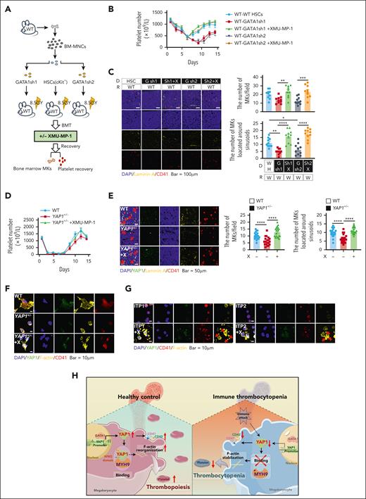 Targeting YAP1 is sufficient to rescue thrombopoiesis in YAP1+/− ITP mice and patients with ITP. (A) Comprehensive schematic overview of the YAP1 rescue mouse model. ckit+ HSCs were isolated from WT mice, and further conducted GATA1 knockdown HSCs using short hairpin RNA. Subsequently, BMT mouse models using GATA1 knockdown BM were established. Seven days after BMT, XMU-MP-1 was administrated once per day for the following 3 days. (B) Changes in the peripheral platelet levels in mice during BMT reconstruction (n ≥ 5). (C) Confocal images of BM sections from WT mice in groups after immunostaining for vascular sinusoids (yellow, laminin A) and MKs (red, CD41). Scale bar, 100 μm. Analysis of MK numbers (top) and the number of MKs located around the sinusoids (bottom; n ≥ 10). (D) The anti-CD41 antibody–induced ITP mouse model was established for 7 days, and XMU-MP-1 was administrated once per day for the following 3 days. Changes in peripheral platelet levels in mice during antibody administration and recovery (n ≥ 6). (E) Confocal images of BM sections from WT and YAP1+/− mice after immunostaining for YAP1 (green, YAP1), vascular sinusoids (yellow, laminin A), and MKs (red, CD41). Scale bar, 50 μm. Analysis of MK numbers (middle) and number of MKs located around the sinusoids (right; n ≥ 10). (F) Confocal images of spreading and cytoskeletal organization in MKs from WT and YAP1+/− mice in groups after immunostaining for YAP1 (green, YAP1), F-actin (yellow, phalloidin), and MKs (red, CD41). Scale bar, 10 μm. (G) XMU-MP-1 (300 nM for 24 hours) treatment facilitated proplatelet formation in MKs from patients with refractory ITP (ITP1) and chronic ITP (ITP2). (H) Proposed model. YAP1 regulates thrombopoiesis by binding to MYH9 in the context of ITP. ∗∗P < .01; ∗∗∗P < .001; ∗∗∗∗P < .0001. G sh1, GATA1sh1; G sh2, GATA1sh2; sh, short hairpin; Sh1 X, GATA1sh1 + XMU; Sh2 X, GATA1sh2 + XMU; W, WT.