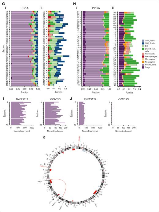 Methodological overview and tomo-seq highlights spatial heterogeneity in 2 whole-tumor lesions. (A) Graphical representation of the patients’ clinical information. Each horizontal line represents a patient. The timeline is segmented and colored according to the duration and treatment agent. The red dot with a cross represents the time at which the biopsies were collected. (B) A scheme illustrating the methods used. (C-D) Longitudinal H&E images of the whole lesion of PT01A (C) and PT10A (D). The horizontal lines represent the approximate locations of the sections used for the tomo-seq. (E-F) Pearson correlation coefficients between every pair of sections calculated using the whole transcriptome profiles for PT01A (E) and PT10A (F). (G-H) Inferred cell type fractions for all sections for PT01A (G) and PT10A (H) generated using CIBERSORT and a reference of RNA sequencing data of pure stroma and immune cell types retrieved from Blueprint and ENCODE. (Gi,Hi) The panel represents all detected cell types, including PCs. (Gii,Hii) Representative fractions of cell types, excluding PCs. (I-J) Normalized counts of GPRC5D and TNFRSF17 in PT01A (I) and PT10A (J). (K) Circos plot of WGS of PT10. A, AraC; Allo SCT, allogeneic stem cell transplantation; B, BCNU; Benda, bendamustine; C, cyclophosphamide; C in PACE, cisplatine; D, doxorubicine; Dara, daratumumab; d/Dex, dexamethasone; E, etoposide; Elo, elotuzumab; F, female; HD, high dose; ide-cel, idecaptagene vicleucel; Ixa, ixazomib; K, carfilzomib; M, male; M/Mel, melphalan; P, prednisone; Pom, pomladomide; R, lenalidomide; T, thalidomide; V, bortezomib.