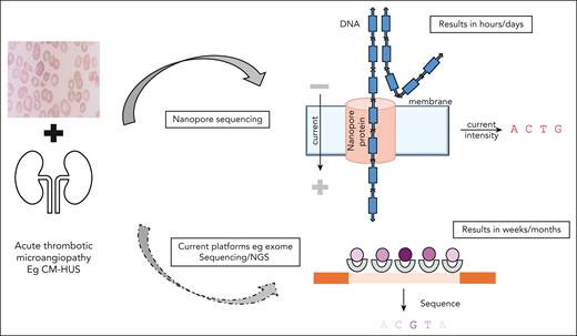 Presentation with a microangiopathic blood picture with acute renal impairment in keeping with CM-HUS. Treatment is initiated with supportive care and possibly complement inhibitor therapy. Confirmation using standard genomic platforms, including exome sequencing or NGS, may take weeks or months. Using nanopore sequencing, the results may be available in hours to days, aiding the rationale to initiate therapy. CM-HUS, complement-mediated hemolytic uremic syndrome; NGS, next generation sequencing.