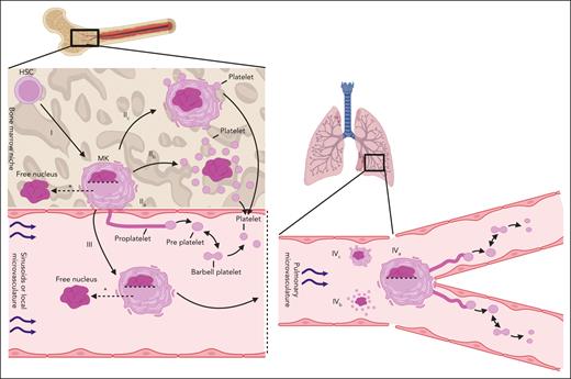 Schematic of the hypothesized platelet production mechanisms in the bone marrow and the lung vasculature. Left-hand side: platelet production in the bone marrow. Right-hand side: platelet production in the lung vasculature. (I) HSCs differentiate and mature into MKs within the bone marrow niche. (II) Thrombopoiesis is hypothesized to occur via 3 different mechanisms in the bone marrow. (IIa) Proplatelet formation in which long, fine protrusions are extended from the bone marrow niche into the sinusoidal vasculature. Shear forces aid in the release of whole proplatelets or large preplatelets that interconvert into barbell platelets that pinch off to form 2 individual platelets. (IIb) Cytoplasmic (explosive) fragmentation in which case preformed platelet territories are released upon MK eruption. (IIc) Membrane budding in which case platelets are formed and released from the MK plasma membrane. (III) Whole MKs migrate out of the bone marrow niche, retaining or leaving behind their nucleus (as indicated by the dotted horizontal line in the nucleus), in the form of large protrusions driven by multiple membrane fusion events. MKs may generate platelets intravascularly as they passage within the venous vasculature. (IV) Thrombopoiesis occurring in the lung vasculature. (IVa) Immobilized MKs extend proplatelets and undergo similar platelet release mechanisms as seen in (IIc), (IVb) cytoplasmic fragmentation, and (IVc) membrane budding. ∗MKs may enucleate within the bone marrow niche26 or within the systemic vasculature50 before thrombopoiesis. Figure created with BioRender.com.