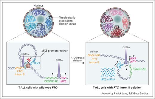 Proposed mechanism of IRX3 oncogenic activation in T-ALL due to the loss of a “promoter tether.” IRX3 resides in a TAD that contains 2 relevant regulatory elements: 1 within intron 8 of FTO and 1 within CRNDE. In cells with wild-type FTO (left panel), the IRX3 promoter is sequestered to a relatively inert region of FTO intron 8, yielding minimal transcriptional activity. This trapping is facilitated by CTCF binding at the FTO intron, which creates an IRX3 “promoter tether.” In T-ALL cells with focal deletions of FTO intron 8 (right panel), the loss of CTCF binding unleashes the IRX3 promoter, allowing it to be hijacked by the distal highly active developmental superenhancer of CRNDE, resulting in oncogenic IRX3 transcription.