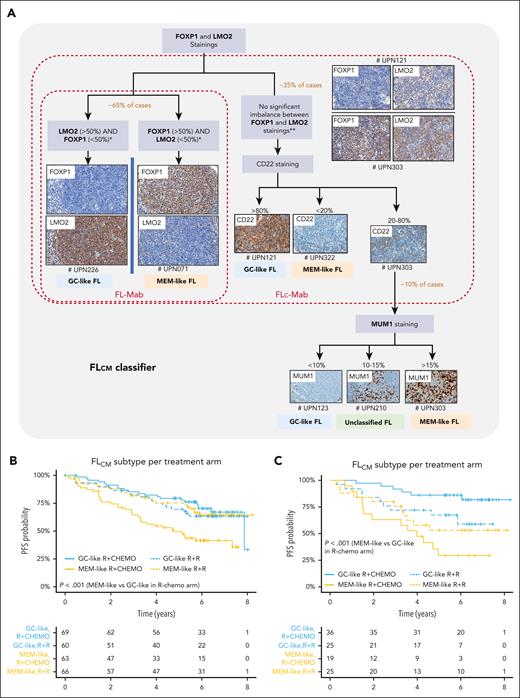 Immunohistochemical FLcm algorithm and its association with clinical outcome. (A) The FLcm algorithm was developed from the RELEVANCE discovery IHC cohort (n = 264) to classify FFPE biopsy samples into MEM-like or GC-like FL. FOXP1, LMO2, CD22, and MUM1 antibodies were used according to a sequential and hierarchical order starting with both FOXP1 and LMO2 staining, which allowed classification of 65% of samples. If there is a clear difference between these 2 immunostainings (mandatory gap >20% between FOXP1 and LMO2 staining), the sample is typed as either MEM-like (FOXP1+/LMO2–) or GC-like (FOXP1–/LMO2+) FL. If there is no clear difference between LMO2 and FOXP1 staining (ie, both FOXP1 <50% and LMO2 <50 % or both FOXP1 >50% and LM02 >50%), a strong CD22 staining calls for GC-like, whereas a weak or negative staining calls for MEM-like FL. In case of moderate CD22 positivity, MUM1 is added as the fourth and final marker. The different steps, cutoff points, and algorithmic processes are depicted. The brown and red frames delineate simpler combinations derived from FLcm, called FLc-Mab (using only FOXP1, LMO2, and CD22) and FL-Mab (using only FOXP1 and LMO2), respectively. Representative immunostainings in RELEVANCE FL samples (# unique patient number, UPN) are shown. (B) PFS curves for the RELEVANCE discovery IHC cohort (n = 258, 6 patients including 4 unclassified cases and 2 untreated patients were excluded) and (C) PFS curves for the RELEVANCE replication IHC cohort (n = 105, 11 patients including 8 unclassified cases and 3 untreated patients were excluded) after stratification using the FLcm algorithm. Both cohorts show significant difference in PFS between patients with GC-like FL and those with MEM-like FL treated by R-chemo.