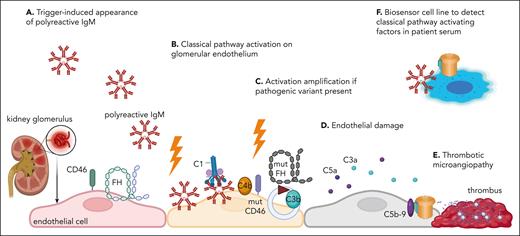 Hypothesis for the pathophysiology of CM-HUS (aHUS), based on the study of Cole et al. (A) A triggering event (infection, pregnancy, inflammation, etc) may result in the appearance of polyreactive IgM antibodies. (B) If directed to glomerular endothelium, they will activate the classical pathway. If this activation is sufficiently strong, it alone may be sufficient to cause endothelial damage and thrombotic microangiopathy. This may occur in patients without genetic risk or anti-FH autoantibodies. (C) In the presence of an at-risk genetic variant (dysfunctional mut FH or CD46 presented in the figure, or factor I or gain-of-function C3 or FB, not illustrated for simplicity) or anti-FH autoantibodies, this classical pathway activation may be amplified to a level, overcoming the tolerable endothelial cell stress, causing (D) endothelial damage, leading eventually to (E) thrombotic microangiopathy. (F) Cole et al propose a new biosensor cell line, sensitive to the presence of classical pathway activators (such as polyreactive IgM), which could be used to detect complement triggers and potentially, after validation, to distinguish CMHUS from other forms of thrombotic microangiopathy. mut, mutated. Figure generated with BioRender.com.
