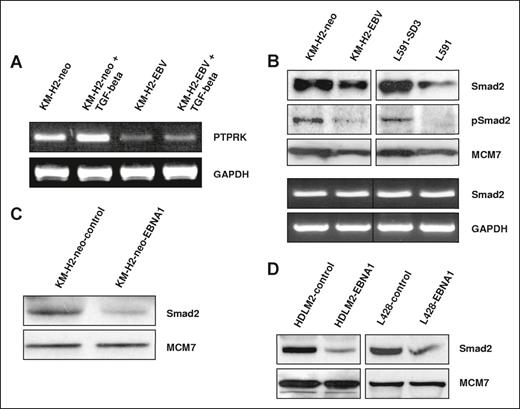 EBV infection or EBNA1 expression inhibits the TGF-beta–mediated activation of PTPRK expression and decreases total and phosphorylated Smad2 protein levels in HL cells. (A) TGF-beta stimulation of KM-H2 HL cells results in the robust up-regulation of PTPRK transcription. However, responsiveness to TGF-beta is reduced by the presence of EBV as demonstrated by a less marked increase in PTPRK transcription in EBV-positive HL cells compared with their EBV-negative counterparts. (B top panel) Immunoblotting shows a reduction in the levels of both total and phosphorylated Smad2 protein in EBV-positive HL cells. (B bottom panel) Semiquantitative RT-PCR demonstrates that SMAD2 transcription is unaffected by the presence of EBV in HL cells. (C) Immunoblotting demonstrates that expression of EBNA1 in EBV-negative KM-H2 cells is sufficient to reduce levels of total Smad2 protein. (D) Immunoblotting shows that expression of EBNA1 in 2 other EBV-negative HL cell lines, HDLM2 and L428, also results in the reduction of total Smad2 protein.