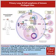 Graphical abstract for: Primary large B-cell lymphomas of immune-privileged sites;