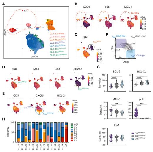 Intrapatient and interpatient heterogeneity of CLL cell subpopulations. (A) UMAP of reclustered healthy B/CLL cells (from Figure 1C) from patients and healthy controls. (B) UMAP plots colored by median protein expression of CD20, pS6, and MCL-1, distinguishing between healthy B cells (CD20high pS6high MCL-1low) and CLL cells (CD20lowpS6lowMCL-1high). (C) UMAP plots colored by protein expression level of IgM, distinguishing IgMhigh and IgMlow B cells. (D) UMAP plots colored by amounts of pRB, TACI, BAX, and pH2AX, thereby distinguishing between 2 minor subpopulations of CLL cells, namely pRBhighTACIhighBAXhigh (cluster 2.9) and pH2AXhigh (cluster 2.10). (E) UMAP plots colored by protein expression of CD5, CXCR4, and BCL-2, thereby distinguishing 2 main subpopulations of CLL cells, namely CD5highCXCR4lowBCL-2high (cluster 2.6) and CD5lowCXCR4highBCL-2v.high (cluster 2.7). (F) Representative 2-dimensional plot of CXCR4 vs CD5 expression showing CD5highCXCR4low and CD5lowCXCR4high CLL cell populations from patient CLL20. (G) Violin plots showing the mean intensities of BCL-2, BCL-XL, MCL-1, pH3, and IgM of old and new CLL cells that have low, medium, and high levels of CXCR4 protein. (H) Frequency of each cluster in the PB of patients before venetoclax treatment. Student paired t test was used. ∗∗∗P < .005; ∗∗∗∗P < .001. BAX, BCL-2 associated protein X; HC, healthy control; pH2AX, phosporylated histone H2AX; pRB, retinoblastoma protein; TACI, transmembrane activator and CAML interactor.