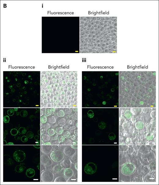 Overexpression of full-length, but not truncated, Mal protein in BEL-A cells results in the expression of AnWj antigen at the cell surface. (A) Flow cytometry with mouse polyclonal anti-Mal (ab167374), human anti-AnWj eluate and monoclonal anti-AnWj (H86) wild-type BEL-A cells (top row), Mal KO BEL-A cells (second row), and BEL-A cells overexpressing either full-length Mal or truncated Mal (exons 1 and 2 only). Only BEL-A cells overexpressing full-length Mal (row 3) show any expression of Mal protein and AnWj antigen detectable by flow cytometry. (B) Full-length Mal (i), N-terminal GFP–tagged full-length Mal (ii), or GFP truncated Mal (iii; exons 1 and 2 only, as potentially expressed in the AnWj-negative patients) were expressed in KO Mal BEL-A cells and observed by confocal microscopy. Full-length Mal (ii) was located throughout the cell (but not in the nucleus) but was predominantly observed on the cell surface, whereas truncated Mal (iii) is localized inside the cell (but again not in the nucleus). Yellow scale bars are 10 μm, and white scale bars are 5 μm. Samples were imaged at 22 °C using 40× oil immersion lenses (magnification, 101.97 μm at zoom 3.8; 1.25 NA) on a TCS SP8 confocal imaging system (Leica). Images were obtained using Leica LAS AF software. KO, knockout; OE, overexpression.