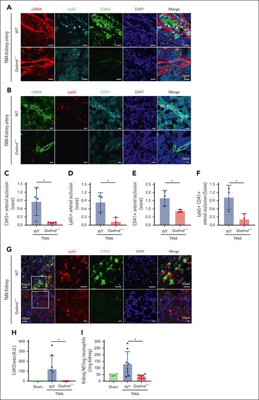 Gsdmd deficiency reduces NETs in both kidney arteries and tissue necroinflammation in focal TMA. (A) Representative immunofluorescent images of NETs (NETs), identified as CitH3-positive areas (green) originating from Ly6G-positive neutrophils (cyan), within αSMA-positive arteries (red) in the TMA kidney. DNA was visualized using DAPI (blue). (B) Representative immunofluorescent images of Ly6G-positive neutrophils (red) and CD41-positive platelets (cyan) within the αSMA-positive arteries (green) in TMA kidneys. DNA was visualized using DAPI (blue). (C-F) Quantification of CitH3 (C), Ly6G (D), CD41 (E), and Ly6G and CD41 (F)-positive areas within αSMA-positive arteries in TMA kidneys from WT and knockout (Gsdmd−/−) mice (n = 3-4 per group). (G) Representative immunofluorescent images of NETs in the peri-infarct of TMA kidneys, identified as CitH3-positive area (green) originating from Ly6G-positive neutrophils (red). DNA was visualized with DAPI (blue). (H) Quantification of the CitH3-positive area in the peri-infarct of sham (n = 4) and TMA kidneys from WT (n = 8) and Gsdmd−/− (n = 8) mice. (I) Absolute numbers of NETing neutrophils (CD45+ CD11b+ Ly6G+ CitH3+) in sham (n = 4) and TMA kidneys from WT (n = 8) and Gsdmd−/− (n = 8) mice, as determined by flow cytometry. Scale bars: for panels A-B, 20 μm, for panel G, 50 μm (low magnification), and 20 μm (high magnification). The data represent mean ± SD. ∗P < .05 using unpaired Student t test for panels C-F or 1-way ANOVA with Tukey post hoc test for panels H-I.