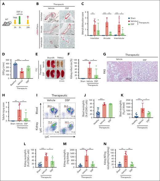 Therapeutic DSF protects mice from TMA, AKI, and ischemic infarction. (A) Illustration of the experimental design. WT mice were administered DSF (50 mg/kg) or vehicle 3 hours after CC-induced TMA in the kidney. Mice were euthanized and analyzed 24 hours surgery. (B) Representative immunohistochemical images of αSMA and fibrin staining of the interlobar, arcuate, and interlobular arteries in TMA kidneys. (C) Quantification of arterial obstruction (n = 3-4 per group). (D) GFR at baseline and 24 hours after focal TMA induction (n = 4 per group). (E) Representative images of TTC staining of TMA (left) and sham (contralateral right) kidneys. The red areas indicate living kidney tissue, whereas the white areas indicate infarcted kidney tissue. (F) Quantification of the kidney infarct size (n = 4 per group). (G) Representative images of PAS staining of TMA kidneys. (H) Quantification of tubular injury (n = 4 per group). (I) Representative gating of flow cytometric analysis for the quantification of neutrophils (CD45+ CD11b+ Ly6G+) and monocytes (CD45+ CD11b+ Ly6C+) in the blood and kidney after focal TMA induction. (J-K) Percentage of neutrophils among CD45+ cells (J) and their absolute number (K) in the blood from healthy mice (n = 10) and focal TMA mice (n = 4 per group). (L-M) Percentage of neutrophils among CD45+ cells (L) and their absolute number (M) in TMA kidneys (n = 3-4 per group). (N) Absolute number of NETing neutrophils (CD45+ CD11b+ Ly6G+ CitH3+) in TMA kidneys (n = 4 per group) as determined by flow cytometry. Scale bars: for panels B,G, 20 μm and for panel E, 4 mm. The data represent mean ± SD. ∗P < .05, ∗∗P < .01, and ∗∗∗P < .001 using 2-way ANOVA with Bonferroni multiple comparisons test for panel C, or 1-way ANOVA with Tukey post hoc test for panels D,F,H,J-N.