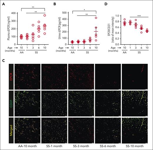 Age-dependent loss of EPCR from the renal vascular endothelium in SS mice. (A) Plasma and (B) urine collected from older (10-month) AA mice (n = 5-6; M, 2; F, 3-4) and differentially aged (1-10 months) SS mice (n = 5-6; M, 2; F, 3-4) showing a gradual age-dependent increase in plasma and urinary sEPCR in SS mice. (C) Representative immunofluorescence images showing the loss of EPCR from the renal microvascular endothelium in older SS mice (6 months or 10 months) compared with younger mice (1 or 3 months). CD31 is an endothelial marker (scale bar = 50 μm). (D) The ratio of the staining intensity of EPCR and CD31 was calculated from the older AA mice (10 months; n = 5; M, 2; F, 3) and SS mice of the indicated age (n = 5; M, 2; F, 3 in each age group) using ImageJ software. The EPCR staining intensity gradually diminished with age in the SS mice. ∗P < .05; ∗∗P < .01; ∗∗∗P < .001 (1-way ANOVA between differentially aged SS mice and unpaired Student t test between 10-month-old AA and SS mice).